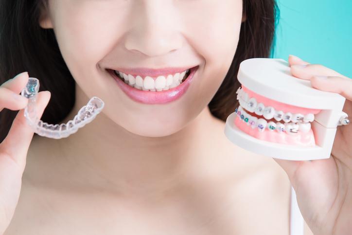 Comparing invisible aligners vs. braces | NewSmile™ 