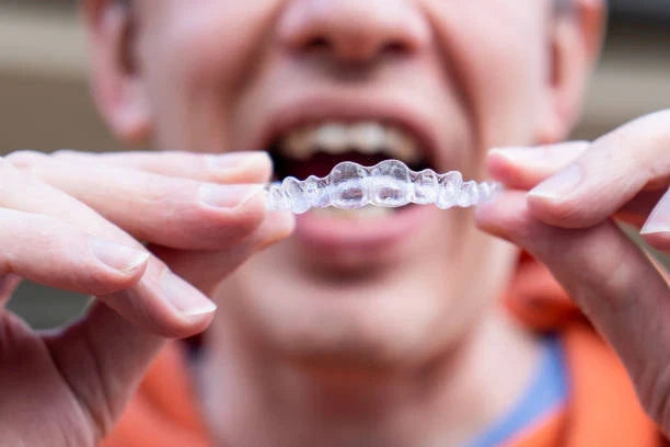 Sports, Sleep, and Smiles: Multi-Purpose Mouthguards 🏀🌙