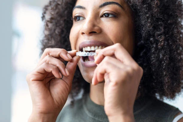 From the Gym to the Game: Mouthguards for Active Lifestyles 🏆