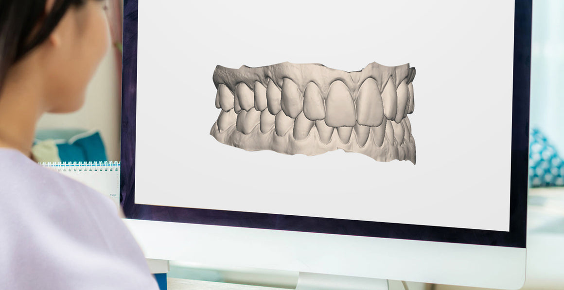 3D Treatment Preview of what your straight teeth | NewSmile clear aligners