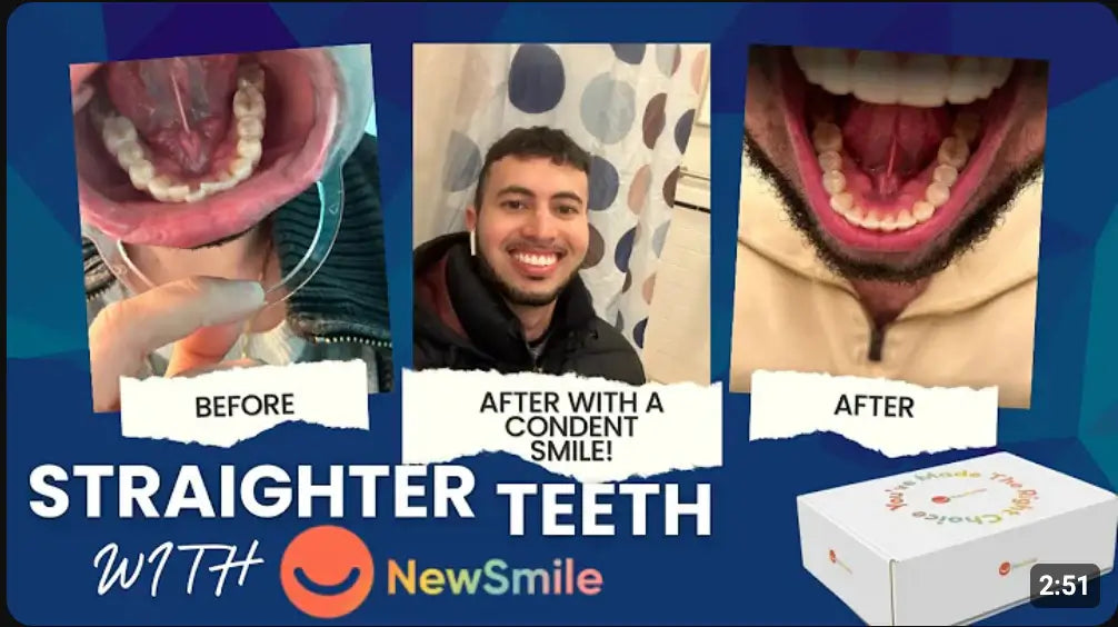 Getting started with NewSmile Clear Aligners! | Stephen's Teeth Straightening Journey